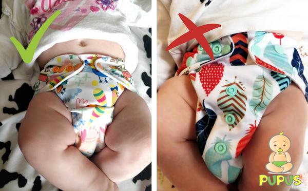 Woran erkennt man, dass eine Windel richtig angelegt ist und gut sitzt?